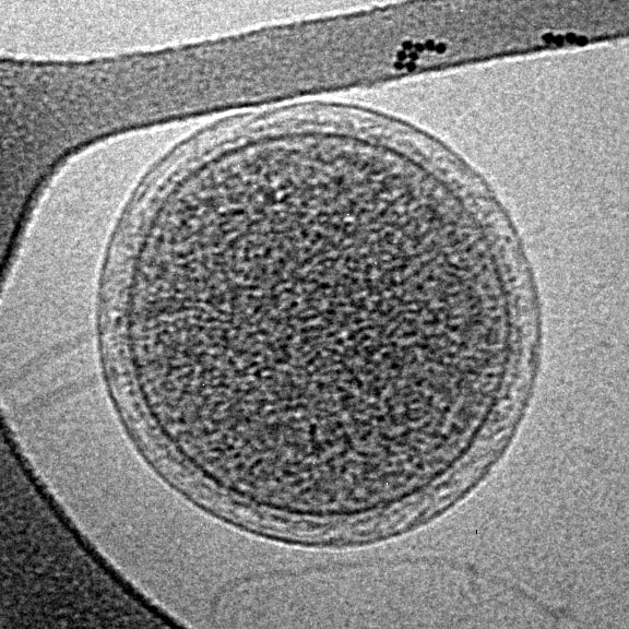 Image of Archaea