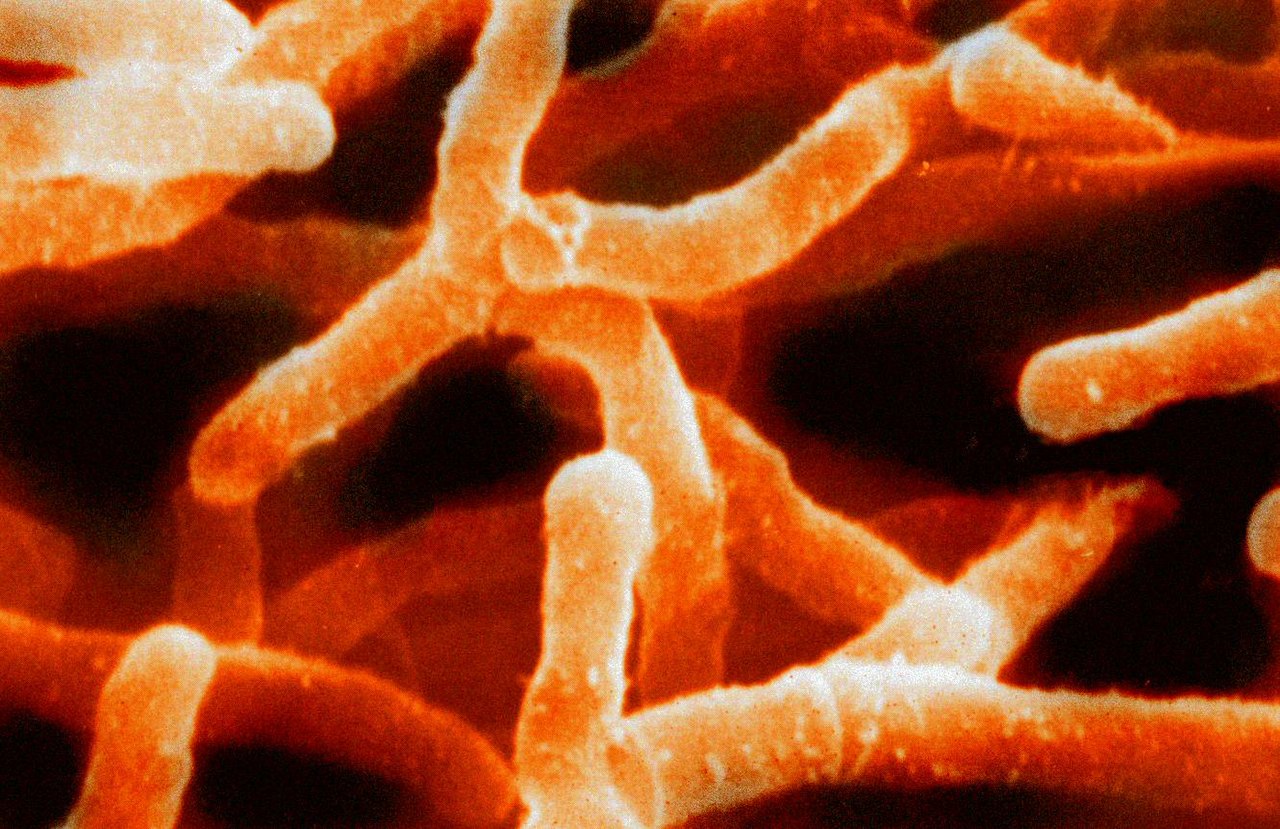 Image of Gram-positive bacteria