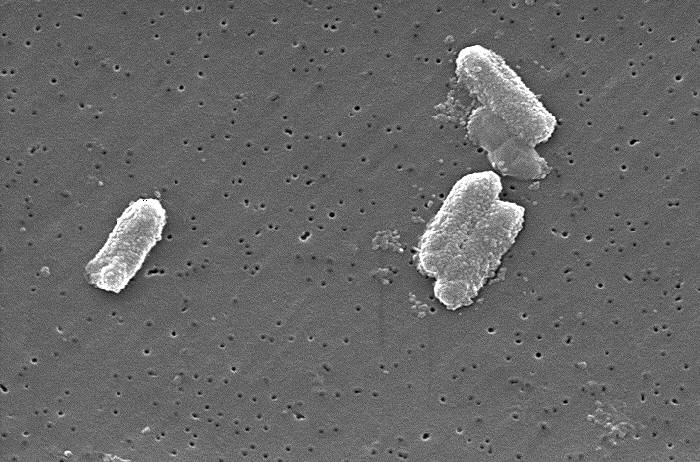 Image of Gram-negative bacteria