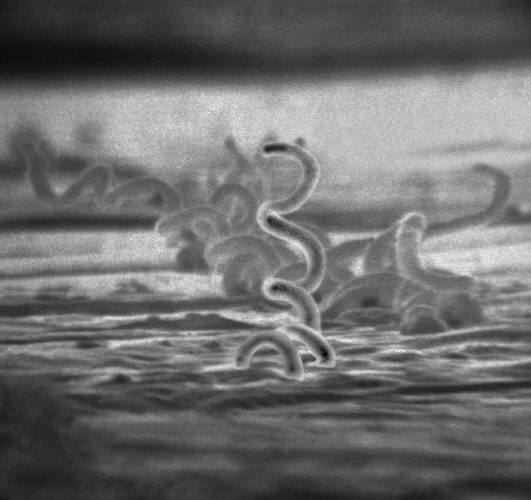 Image of Spirochetes